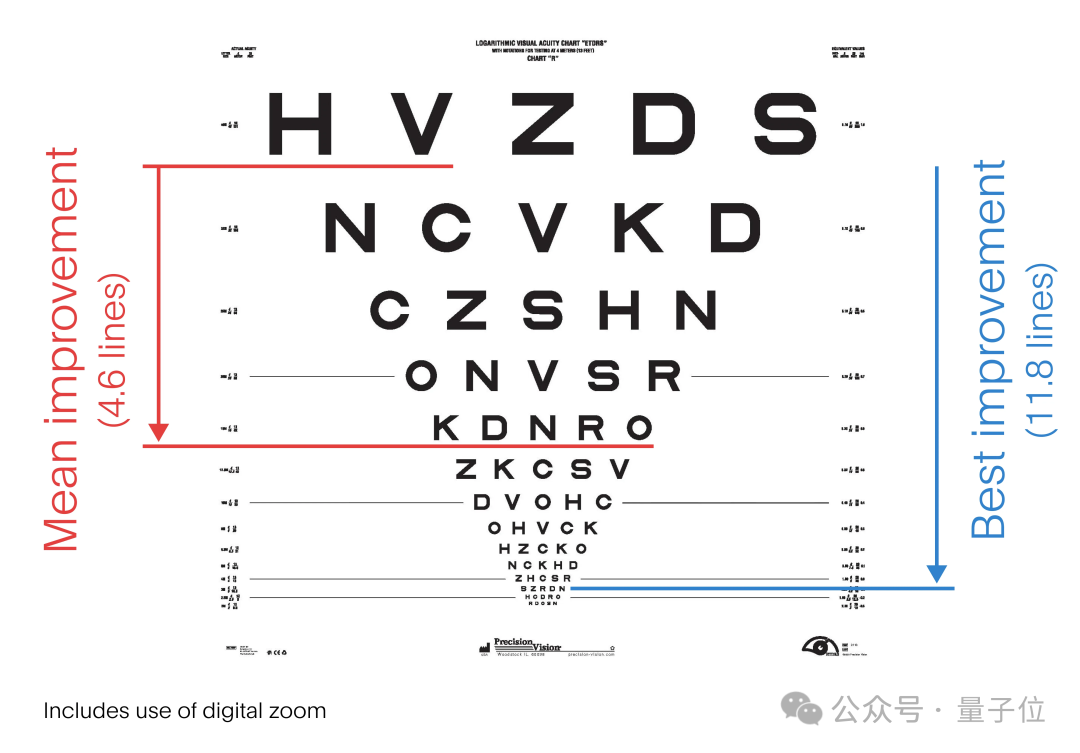 马斯克老部下创业成果：2mm 芯片植入视网膜，盲人重获阅读能力还能打牌