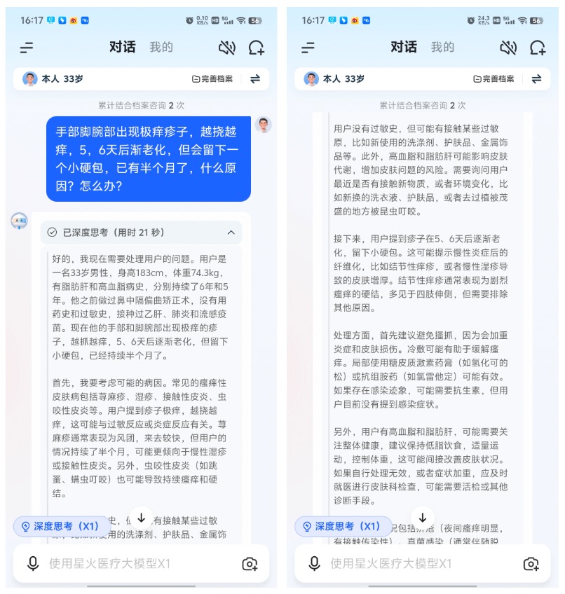【评测室】讯飞晓医体验评测:星火医疗大模型 X1 加持,更懂你的 AI 健康助手 20250307101503