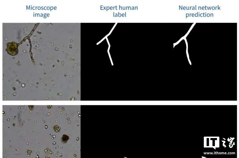 AI 赋能传统显微镜，美研团队研发低成本土壤真菌检测系统